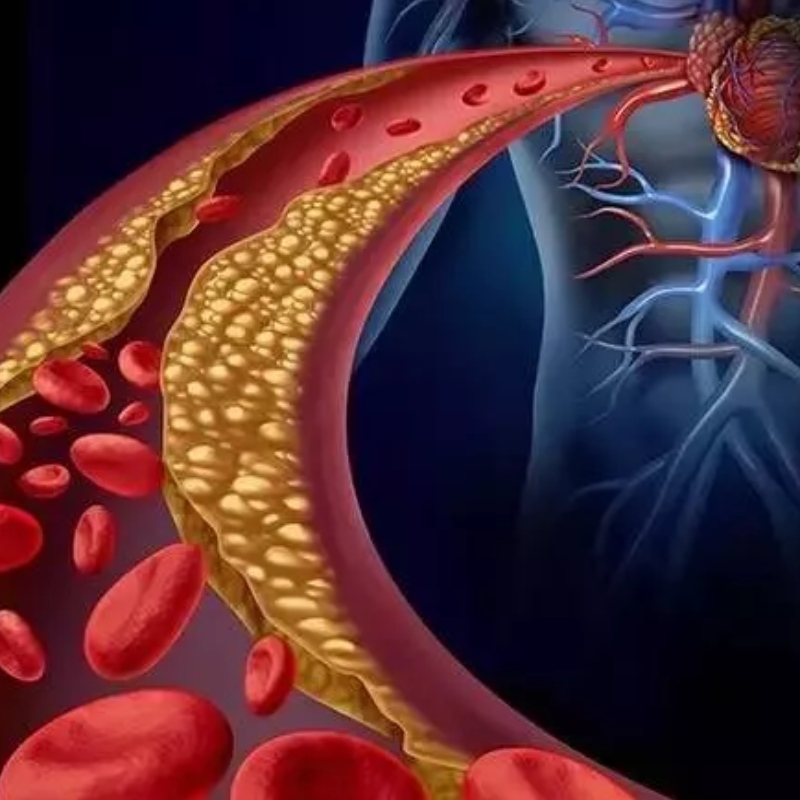 University of Japan: NMN har potential att lindra arteriell styvhet